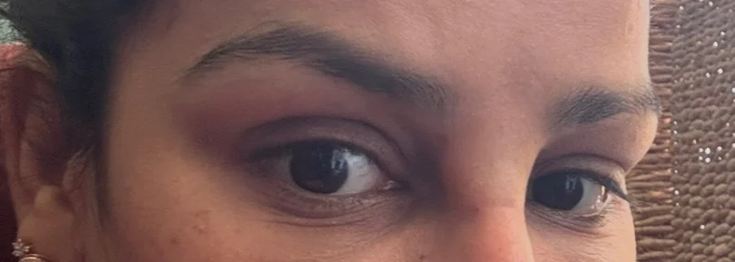 Before treatment — view 1