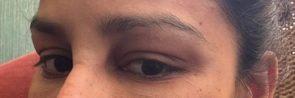 Before treatment — view 2